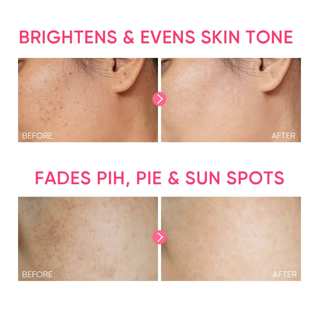 SKINTIFIC MSH Niacinamide Brightening Moisture Gel - Glamorush