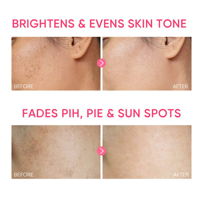 SKINTIFIC MSH Niacinamide Brightening Moisture Gel - Glamorush